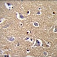 FBXO21 Rabbit Polyclonal Antibody