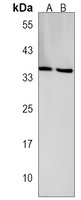 MTHFD2L Rabbit Polyclonal Antibody