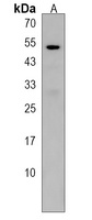 PRAMEF10 Rabbit Polyclonal Antibody