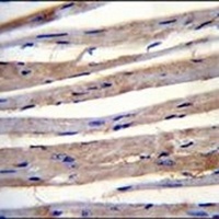 KRT73 Rabbit Polyclonal Antibody