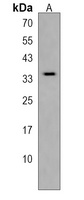 MOGAT2 Rabbit Polyclonal Antibody