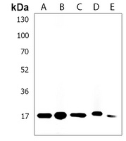 IFITM5 Rabbit Polyclonal Antibody