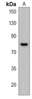 TTC39B Rabbit Polyclonal Antibody