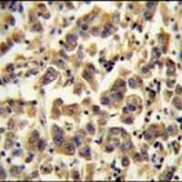 TTC39B Rabbit Polyclonal Antibody