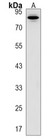 ASAP3 Rabbit Polyclonal Antibody