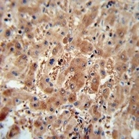 ASAP3 Rabbit Polyclonal Antibody