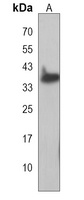 HMCES Rabbit Polyclonal Antibody