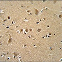 WIPF2 Rabbit Polyclonal Antibody