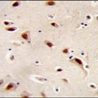 IQCJ Rabbit Polyclonal Antibody