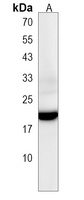 ORMDL2 Rabbit Polyclonal Antibody