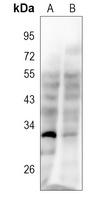 CD37 Rabbit Polyclonal Antibody