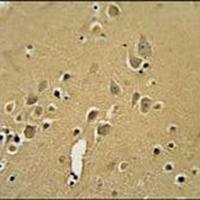 AMY2B Rabbit Polyclonal Antibody