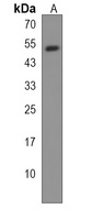 IGSF5 Rabbit Polyclonal Antibody