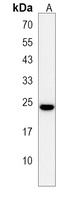 CRIP3 Rabbit Polyclonal Antibody