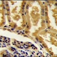 CRIP3 Rabbit Polyclonal Antibody