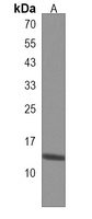 ISCA2 Rabbit Polyclonal Antibody