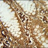 CIART Rabbit Polyclonal Antibody