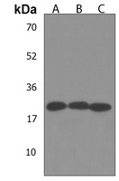 PEMT Rabbit Polyclonal Antibody