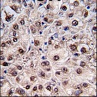 PEMT Rabbit Polyclonal Antibody