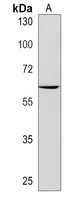 MOCS1 Rabbit Polyclonal Antibody