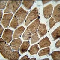 MOCS1 Rabbit Polyclonal Antibody