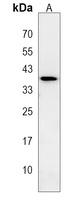 LGALS9B Rabbit Polyclonal Antibody
