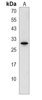 ARL14EP Rabbit Polyclonal Antibody