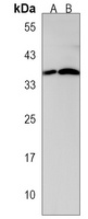 CTDSPL Rabbit Polyclonal Antibody