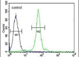 CTDSPL Rabbit Polyclonal Antibody