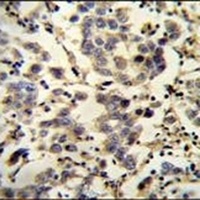C6orf58 Rabbit Polyclonal Antibody