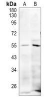 MLKL (Phospho-S345) Rabbit Polyclonal Antibody