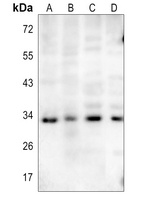 STING (Phospho-S366) Rabbit Polyclonal Antibody