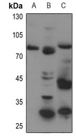ABCB7 Rabbit Polyclonal Antibody