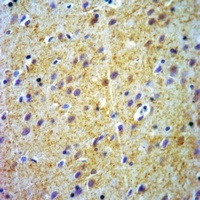 ABCB7 Rabbit Polyclonal Antibody