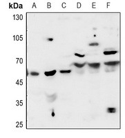 Acetylcholinesterase Antibody