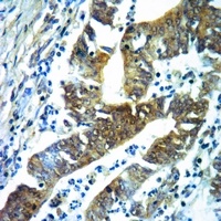 Acetylcholinesterase Antibody