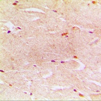 Alpha-actin-3 Rabbit Polyclonal Antibody