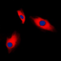 Alpha-actin-3 Rabbit Polyclonal Antibody