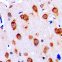 ALK1 Antibody
