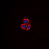 ALK1 Antibody