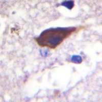 Beta-2 Adrenergic Receptor (Phospho-S346) Rabbit Polyclonal Antibody