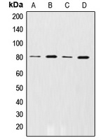 GRK2 (Phospho-S29) Rabbit Polyclonal Antibody