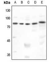 GRK2 Rabbit Polyclonal Antibody
