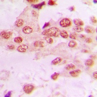 GRK2 Rabbit Polyclonal Antibody