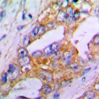 Aggrecan Rabbit Polyclonal Antibody