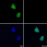 Aggrecan Rabbit Polyclonal Antibody