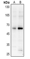 AKT (Phospho-S473) Antibody