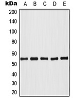 AKT (Phospho-T308) Antibody