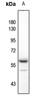 AKT (Phospho-Y315) Rabbit Polyclonal Antibody