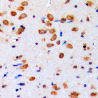 AKT (Phospho-Y315) Rabbit Polyclonal Antibody